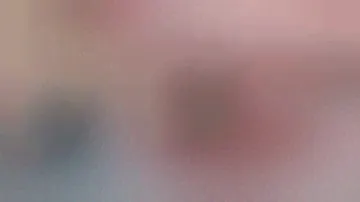 Удаление имплантатов Альфа-Био