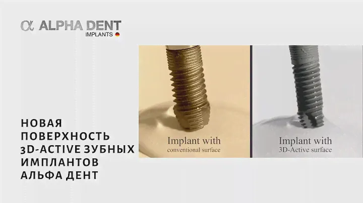 Новая поверхность 3D-Active зубных имплантов Альфа Дент