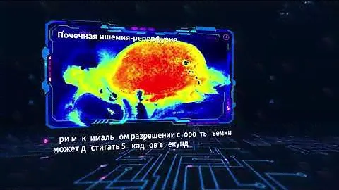 Система лазерной спекл-визуализации RFLSI ZW